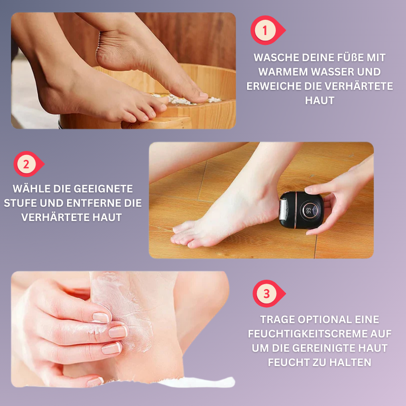 Smooth Skin Hornhautentferner