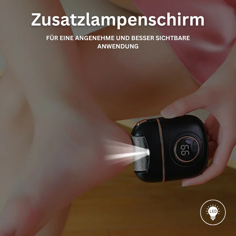 Smooth Skin Hornhautentferner