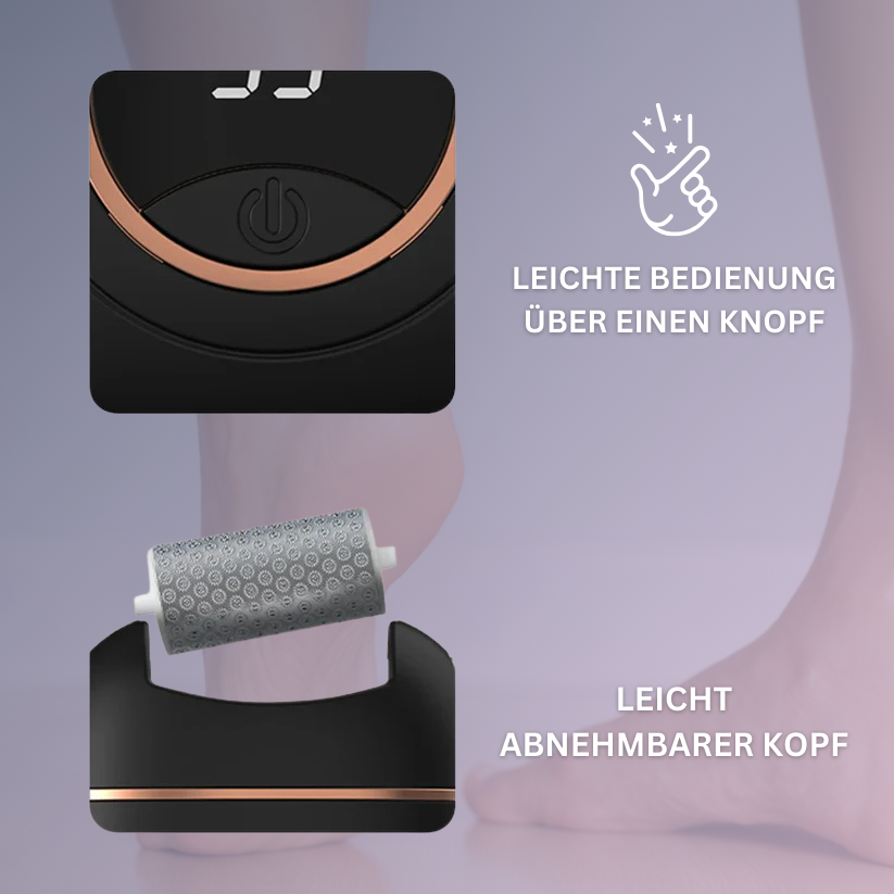 Smooth Skin Hornhautentferner